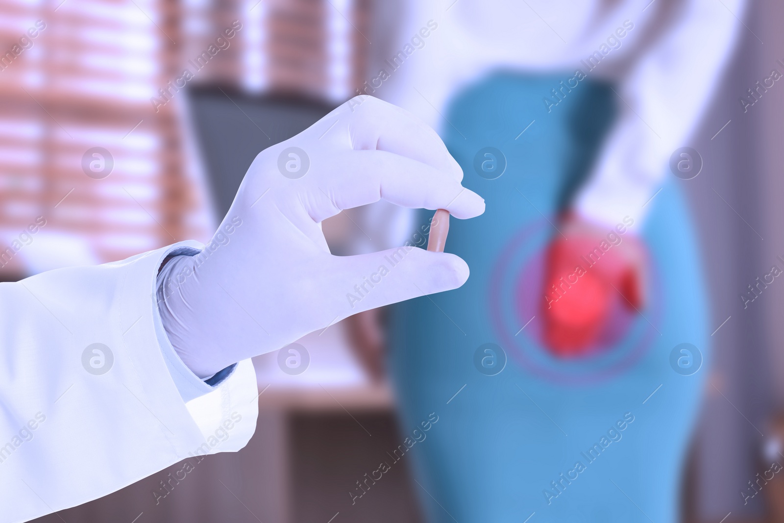 Image of Doctor holding suppository for hemorrhoid treatment and woman suffering from pain, closeup