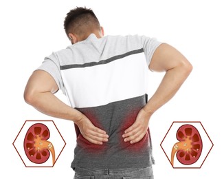 Man suffering from pain because of kidney stones disease on white background