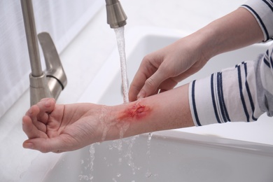 Photo of Woman holding forearm with burn under flowing water indoors, closeup