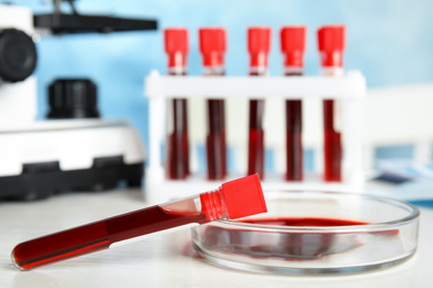 Photo of Test tube and Petri dish with blood samples on table in laboratory, closeup. Virus research
