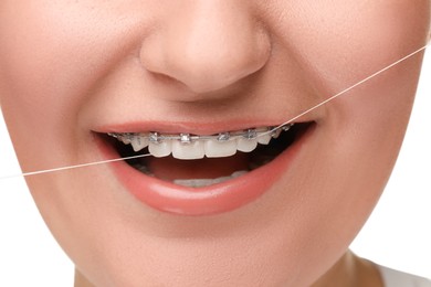Photo of Woman with braces cleaning teeth using dental floss on white background, closeup