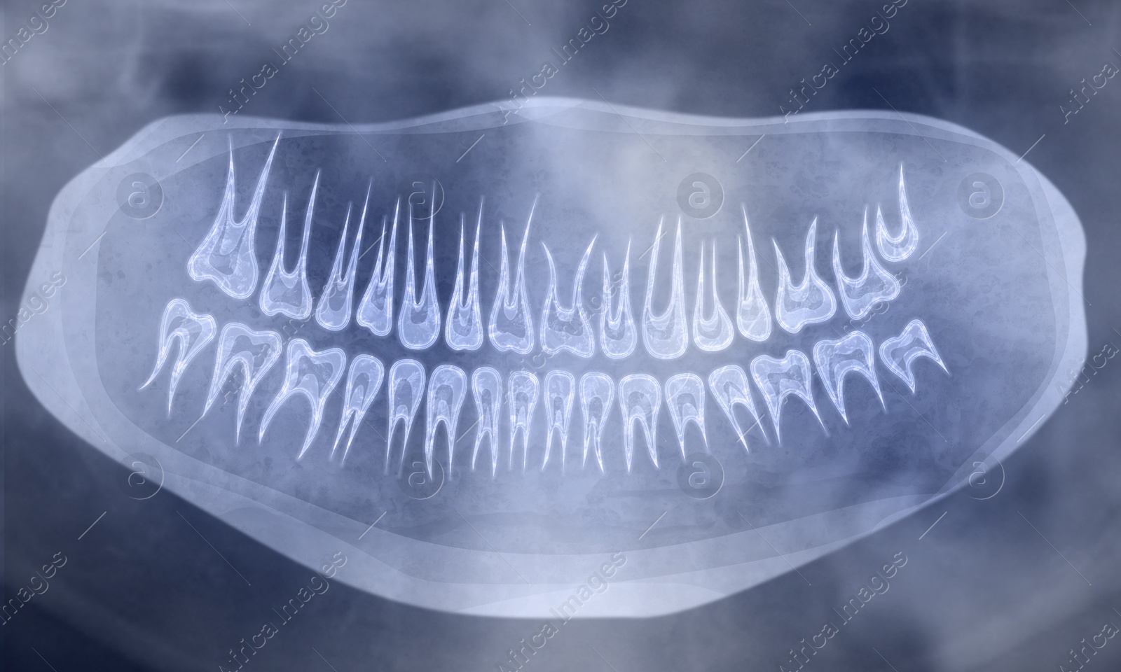 Illustration of X-ray picture of oral cavity with teeth