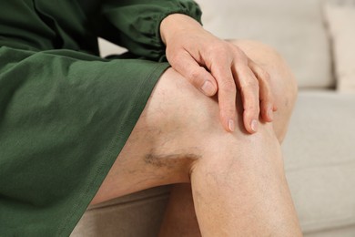 Woman with varicose veins on sofa in room, closeup