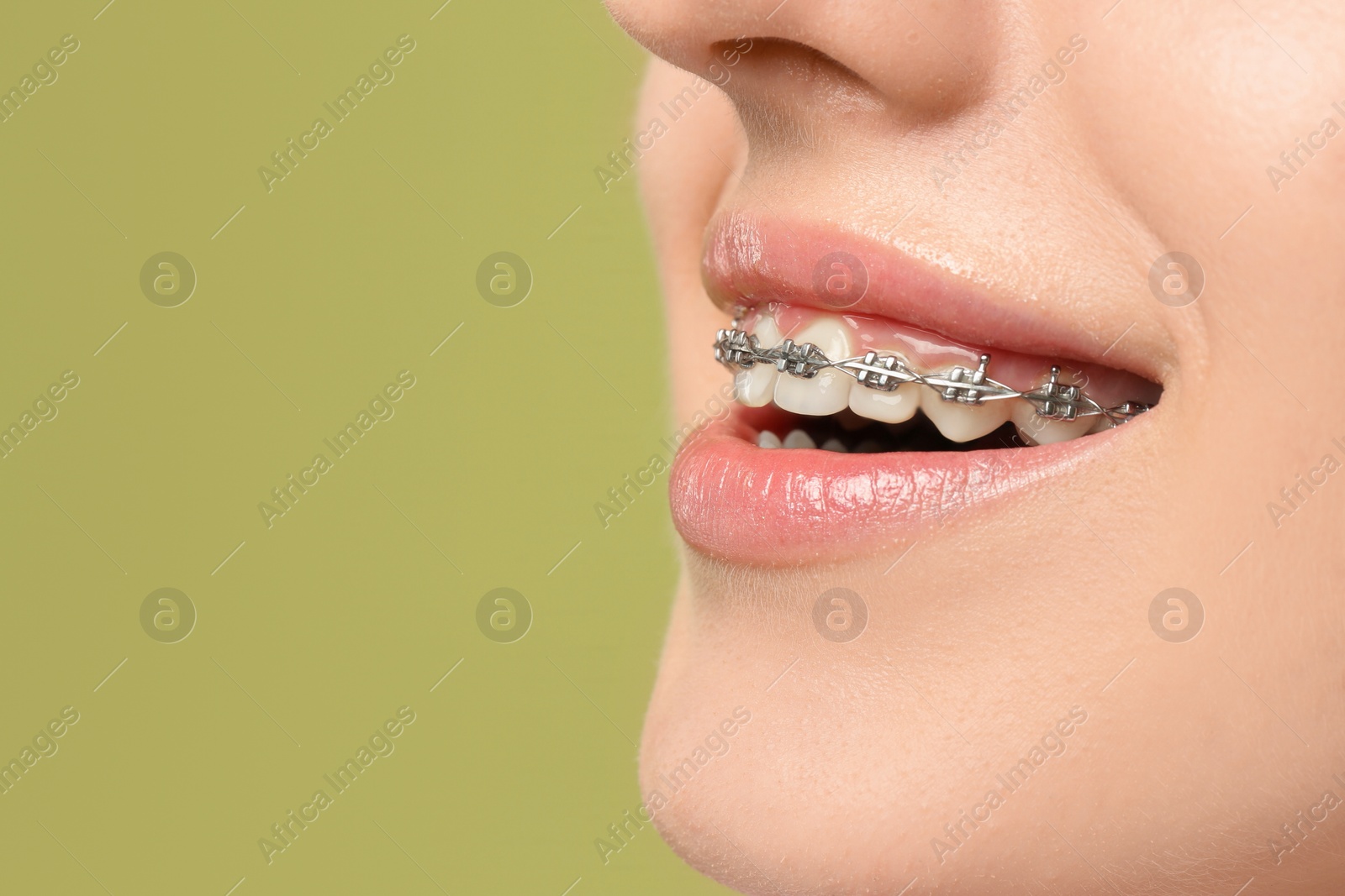 Photo of Smiling woman with dental braces on light green background, closeup. Space for text