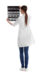 Photo of Orthopedist holding X-ray picture on white background