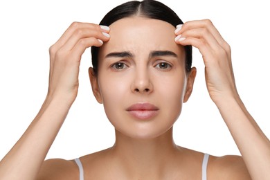 Photo of Young woman with dry skin on white background