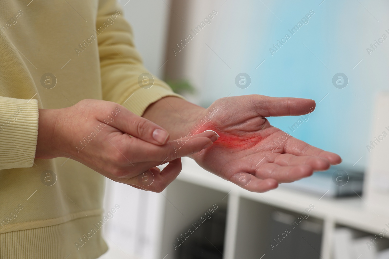 Photo of Woman applying healing cream onto burned hand indoors, closeup