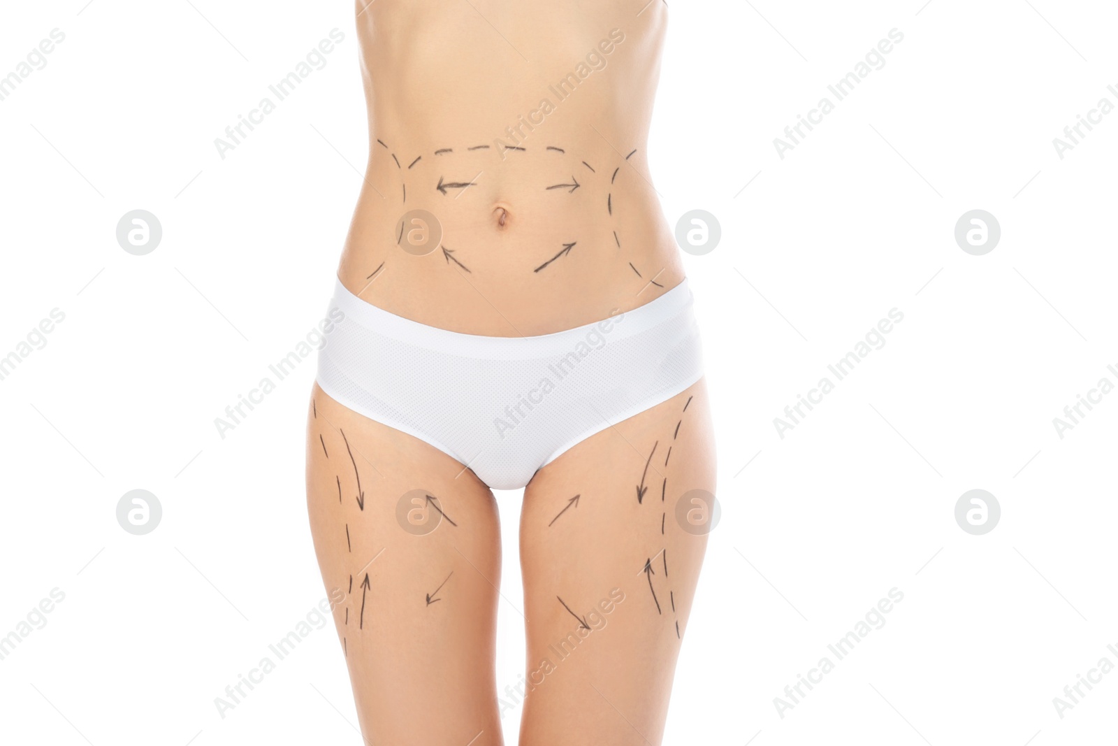 Photo of Woman with marks on body for cosmetic surgery operation against white background, closeup