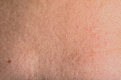 Photo of Closeup view of human skin as background
