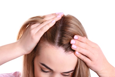 Young woman with hair loss problem on white background, closeup