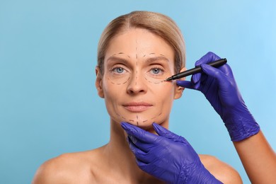 Photo of Doctor with marker preparing patient for cosmetic surgery operation on light blue background