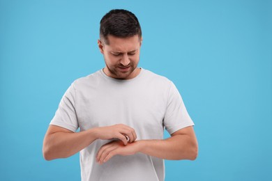 Photo of Allergy symptom. Man scratching his hand on light blue background