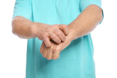 Photo of Mature man scratching hand on white background, closeup. Annoying itch