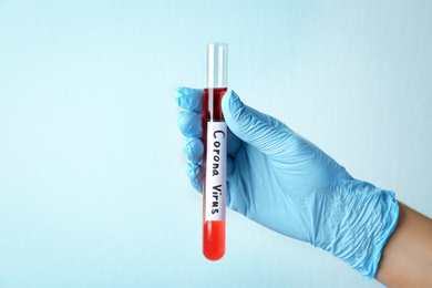 Photo of Woman holding test tube with red liquid and inscription CORONA VIRUS on light background, closeup