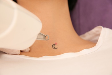 Photo of Young woman undergoing laser tattoo removal procedure in salon, above view