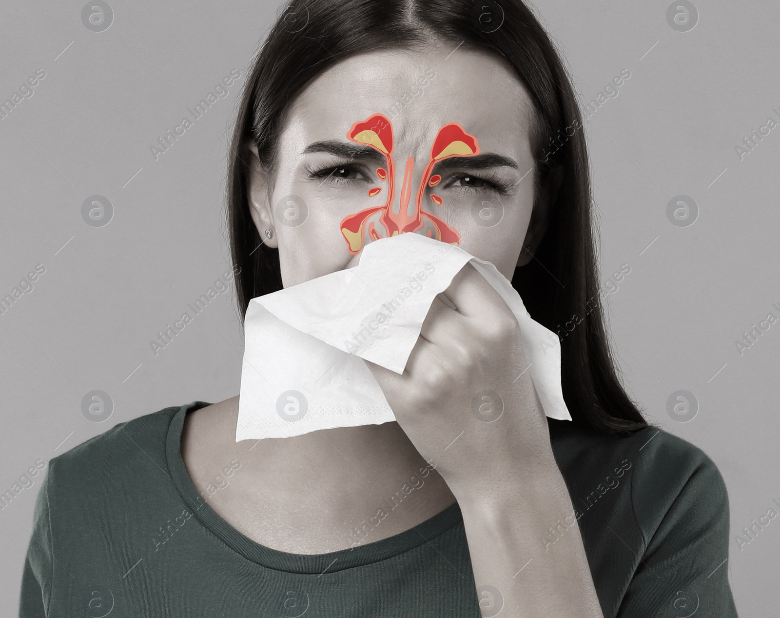 Image of Woman suffering from runny nose as allergy symptom. Sinuses illustration on face