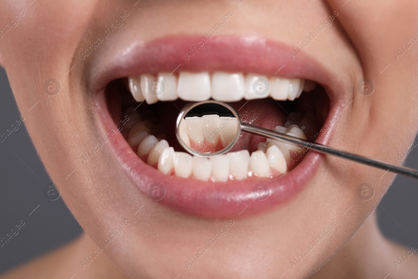 Photo of Examining woman's teeth with dentist's mirror on grey background, closeup