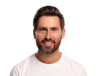 Image of Man with markings for cosmetic surgery on his face against white background