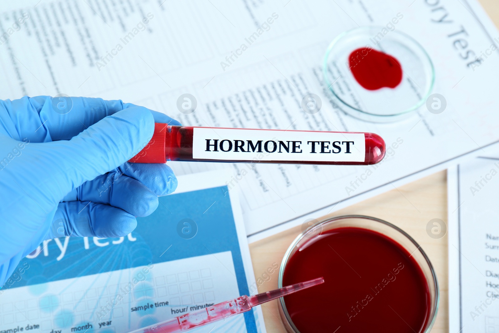 Photo of Hormones test. Scientist holding sample tube with blood at table, closeup