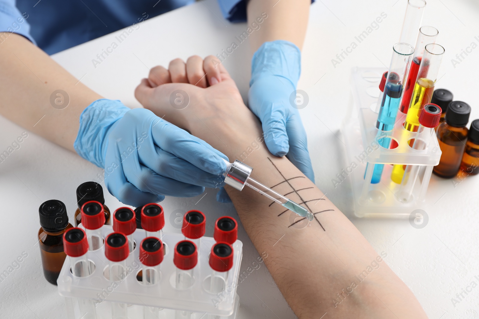 Photo of Doctor doing skin allergy test at light table, closeup