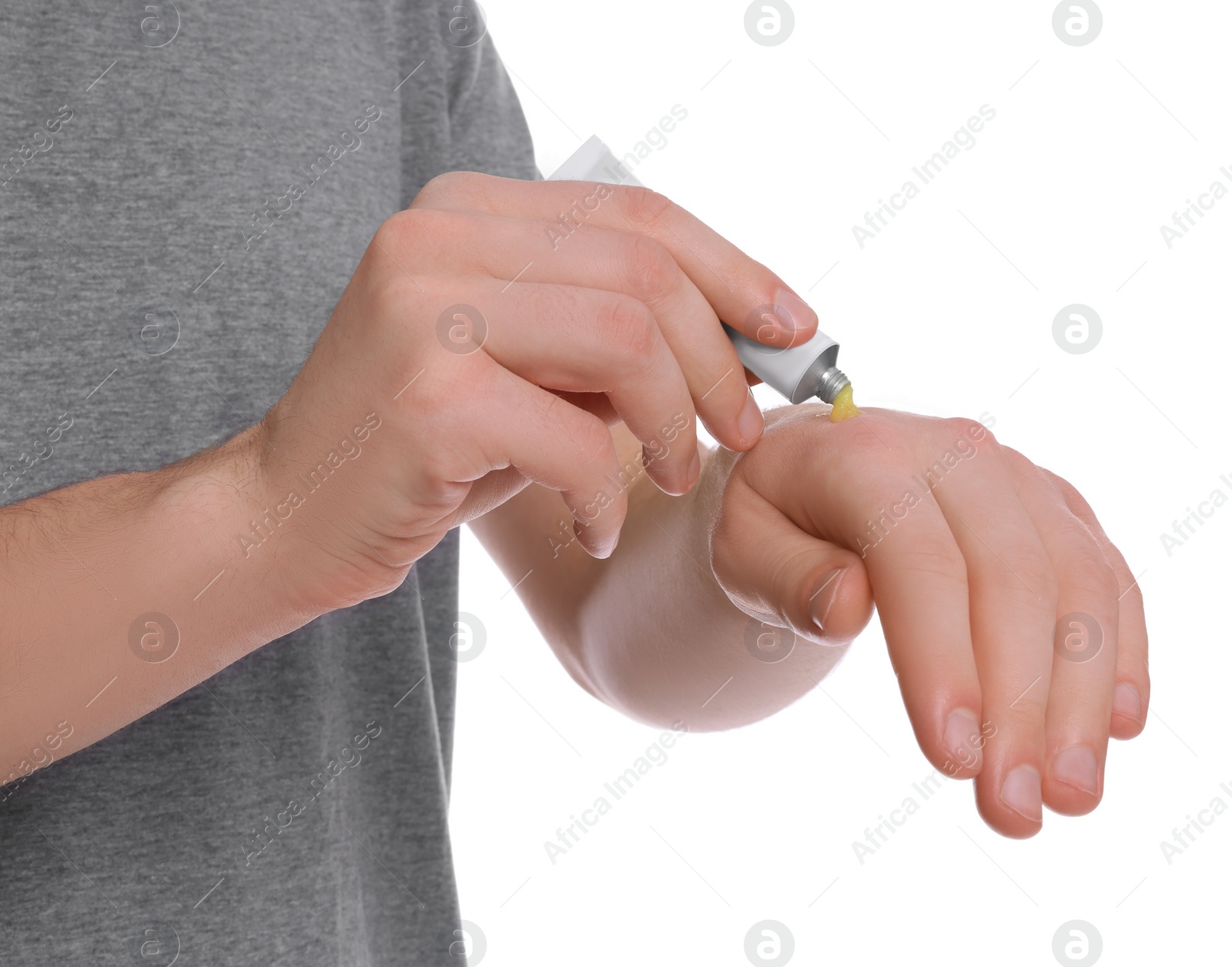 Photo of Man applying yellow ointment from tube onto his hand on white background, closeup