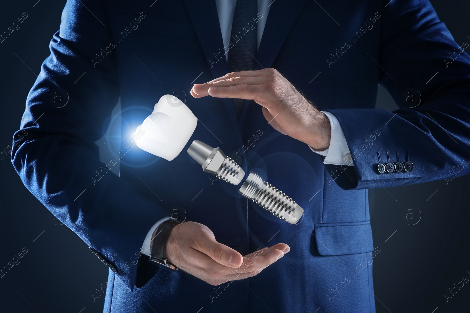 Image of Man demonstrating dental implant on dark background, closeup