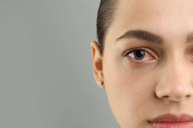 Woman with red eye suffering from conjunctivitis on grey background, closeup
