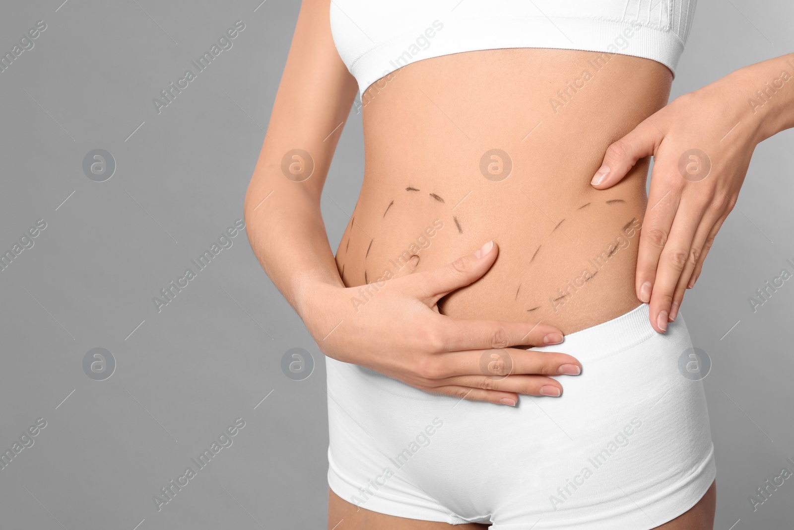 Photo of Young woman with marks on body for cosmetic surgery operation against grey background, closeup. Space for text