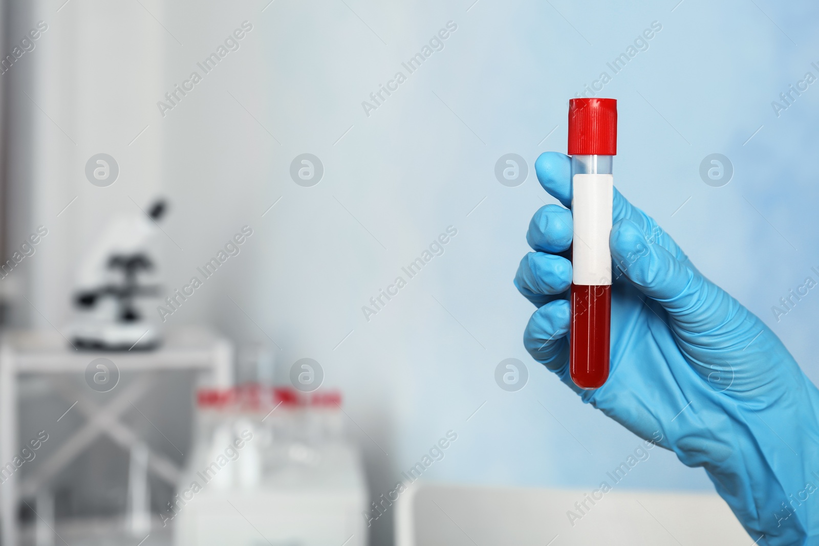 Photo of Doctor holding glass tube with blood sample indoors. Allergy test