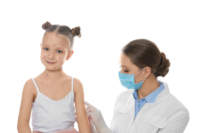 Doctor examining little girl with chickenpox on white background. Varicella zoster virus