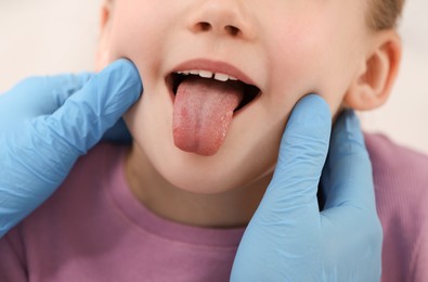 Photo of Doctor examining girl`s oral cavity, closeup view