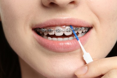 Smiling woman with dental braces cleaning teeth using interdental brush, closeup