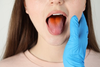 Gastroenterologist examining patient with yellow tongue on light grey background, closeup