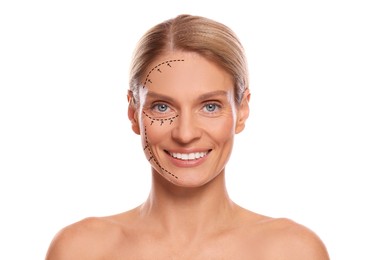 Woman with markings for cosmetic surgery on her face against white background