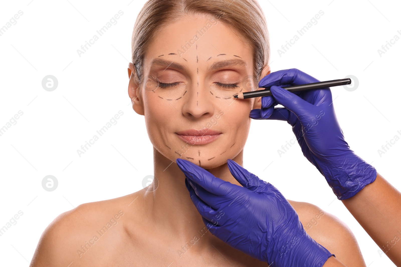 Photo of Doctor with pencil preparing patient for cosmetic surgery operation on white background, closeup