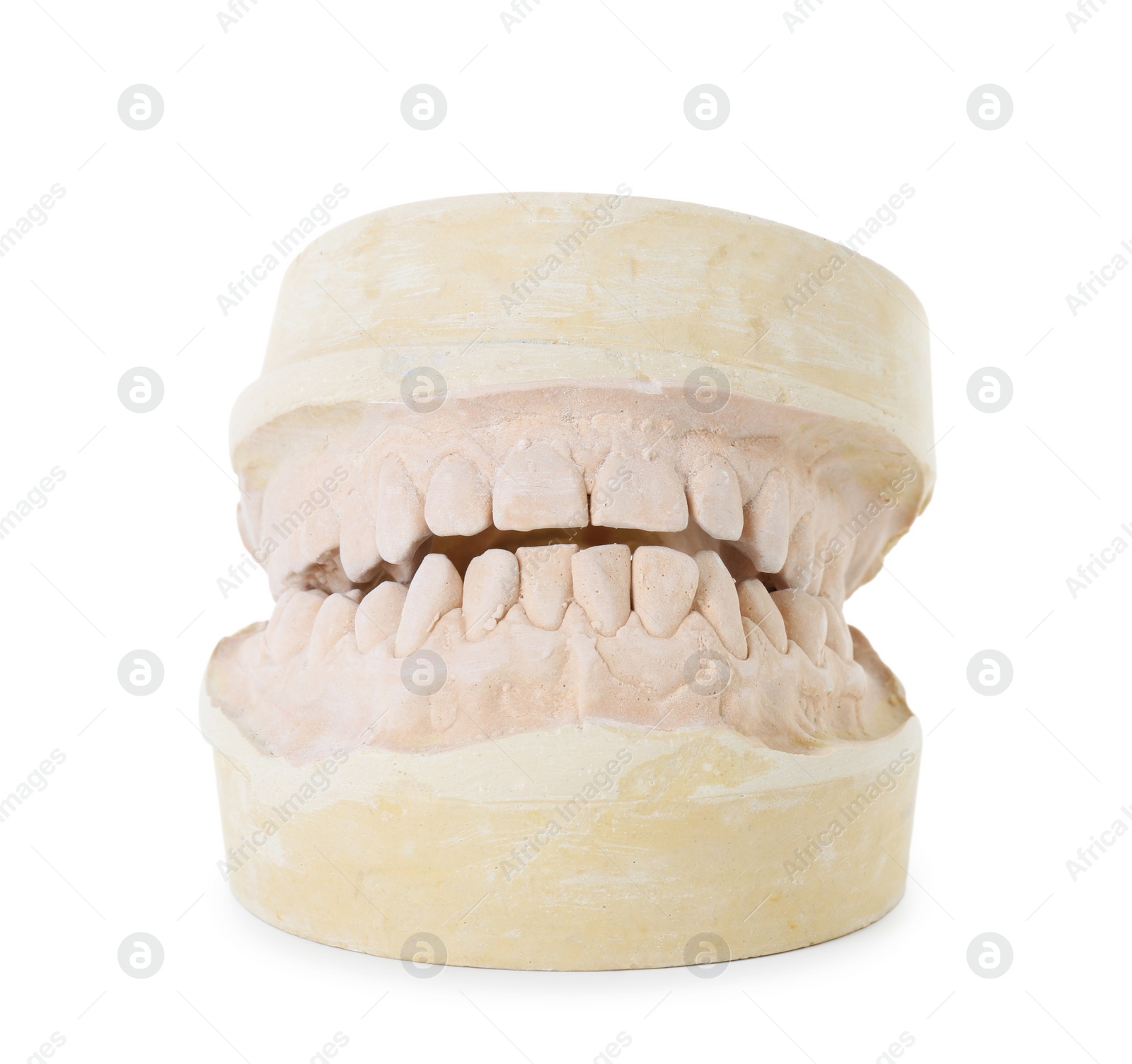 Photo of Dental model with jaws isolated on white. Cast of teeth