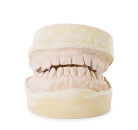Photo of Dental model with jaws isolated on white. Cast of teeth