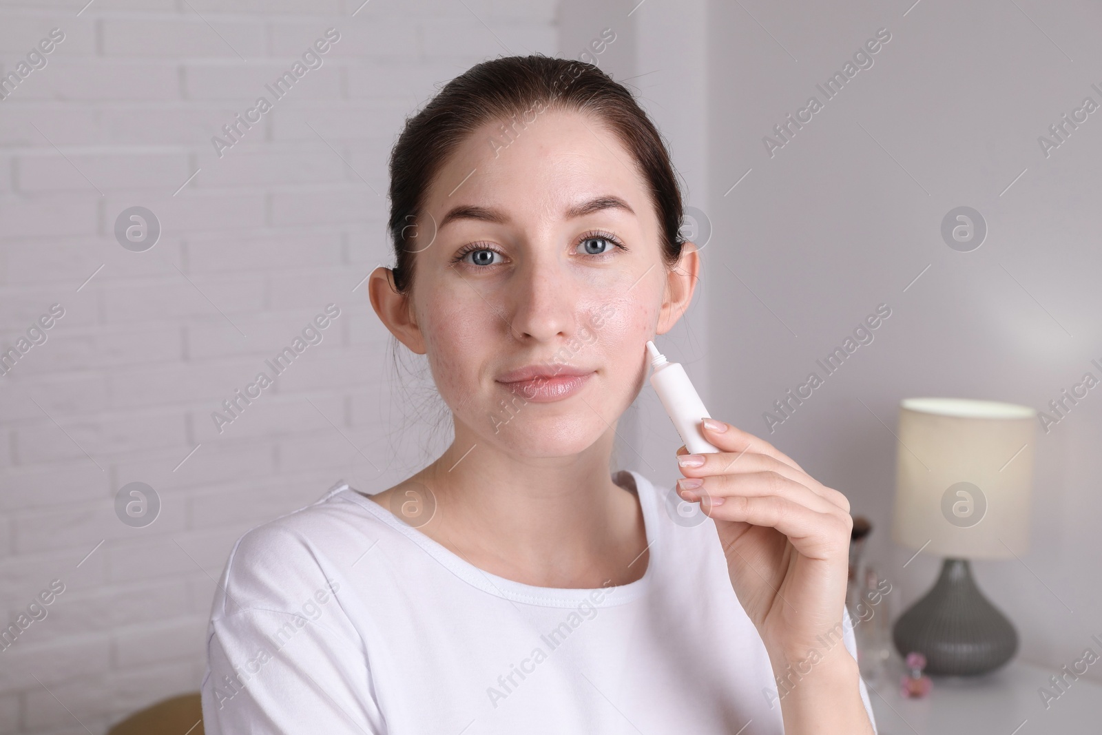 Photo of Woman with acne problem applying cream at home