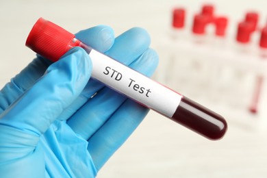 Photo of Scientist holding tube with blood sample and label STD Test on white background, closeup