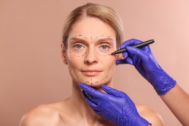 Photo of Doctor with marker preparing patient for cosmetic surgery operation on light brown background