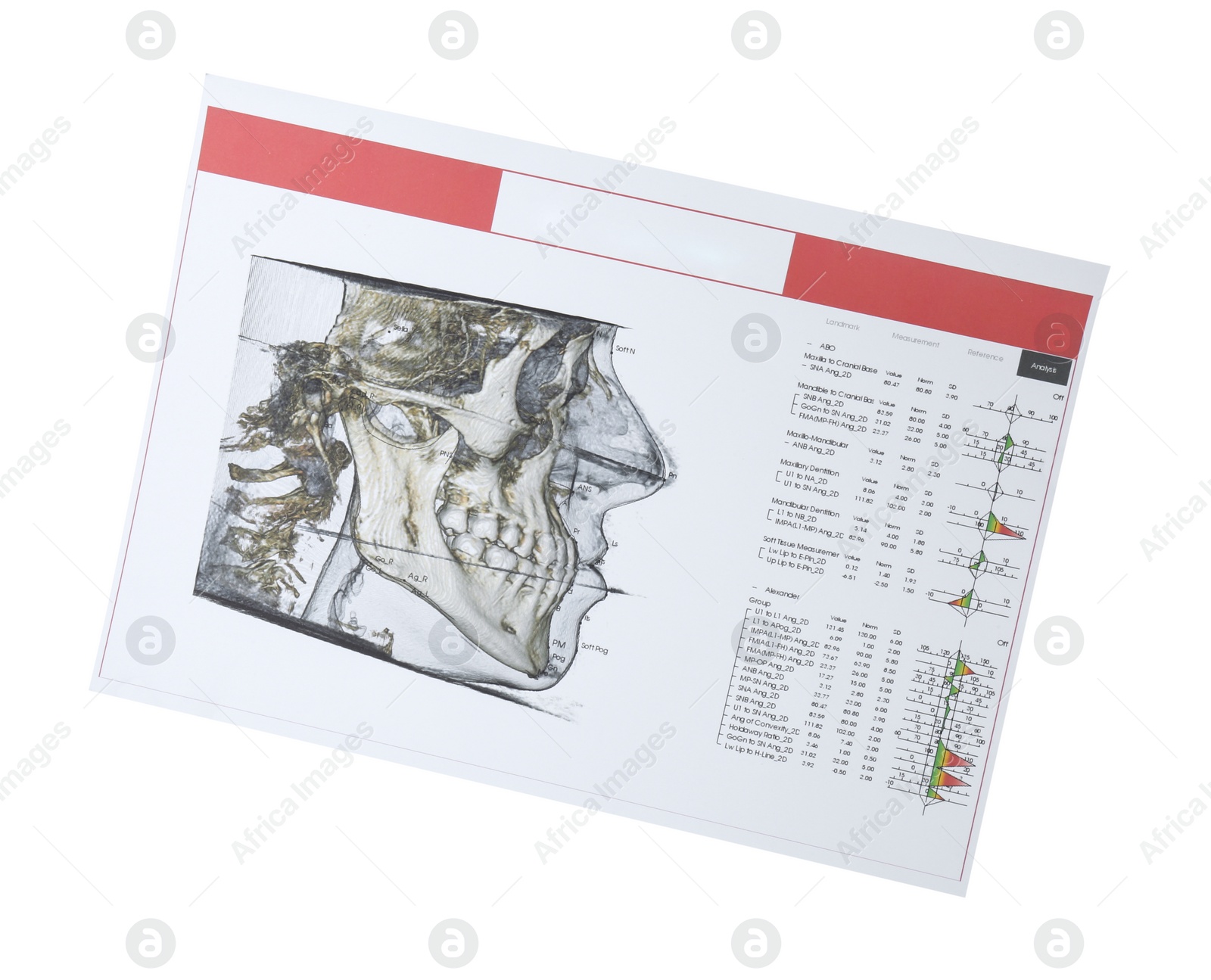 Photo of Visualization of human maxillofacial section for dental analysis printed on paper isolated on white