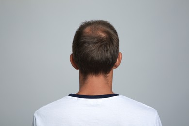 Photo of Man with hair loss problem on light grey background, back view