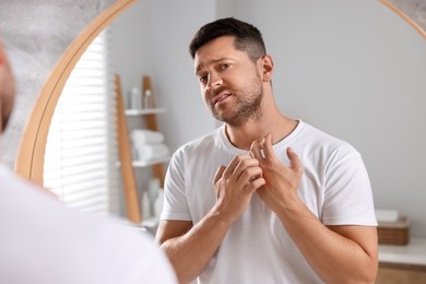 Man suffering from allergy looking in mirror and scratching his hand indoors