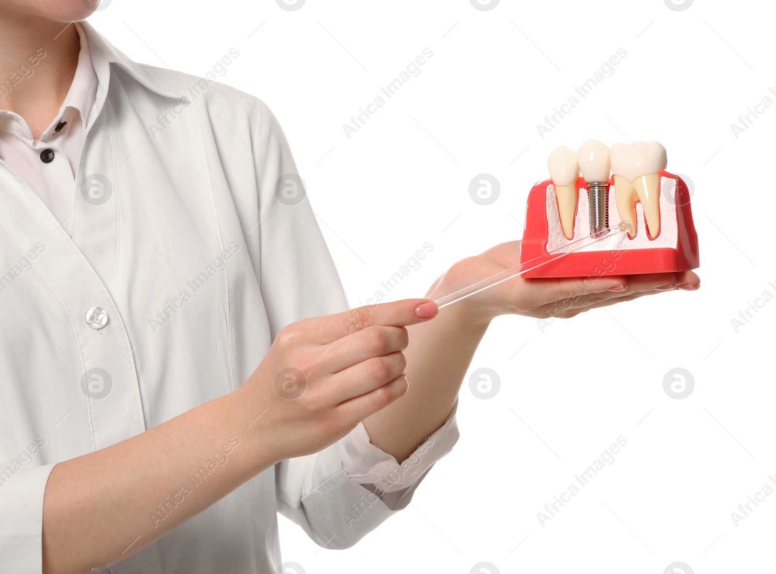 Photo of Dentist holding educational model of dental implant on white background, closeup