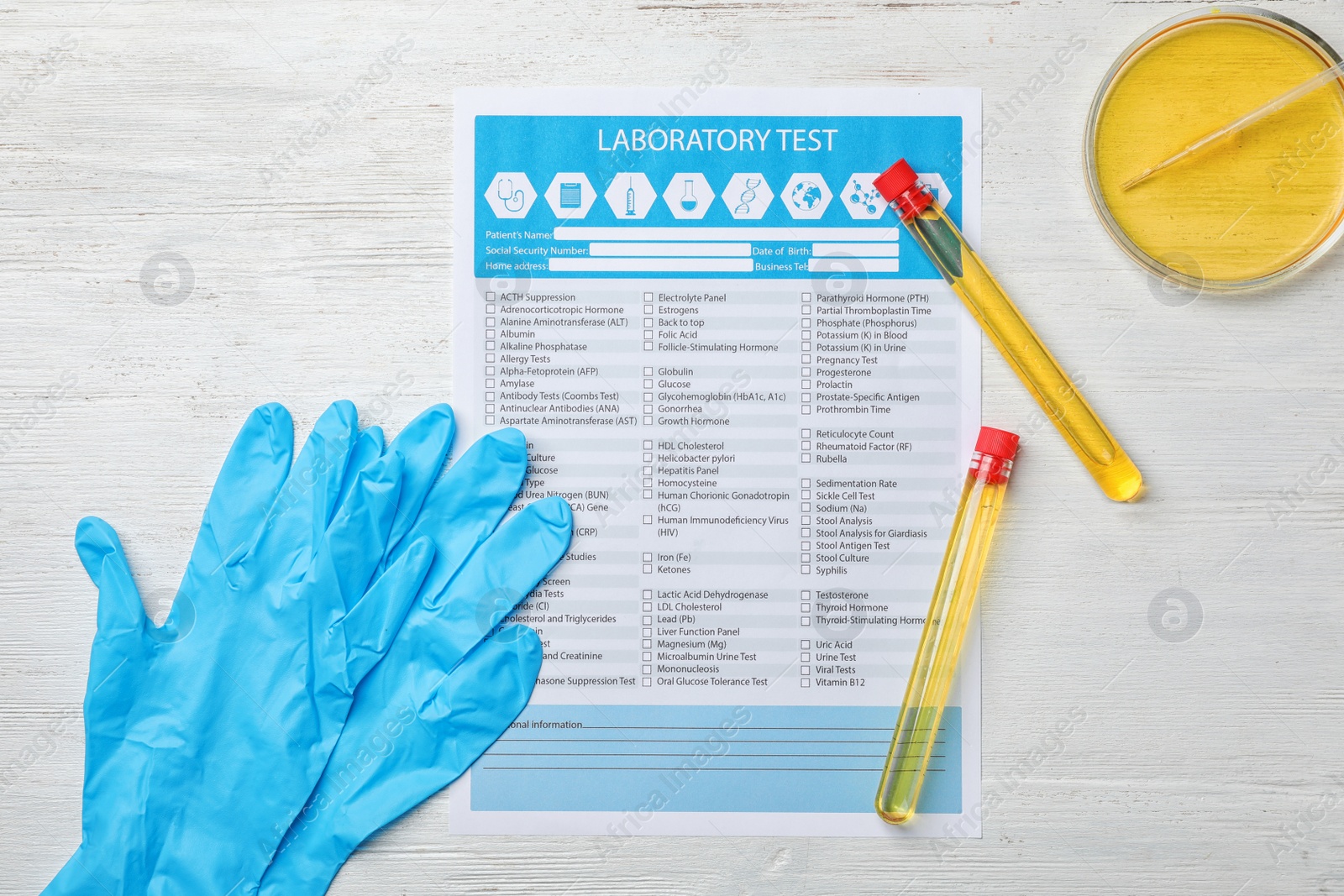 Photo of Flat lay composition with laboratory equipment and urine samples on light background. Urology concept