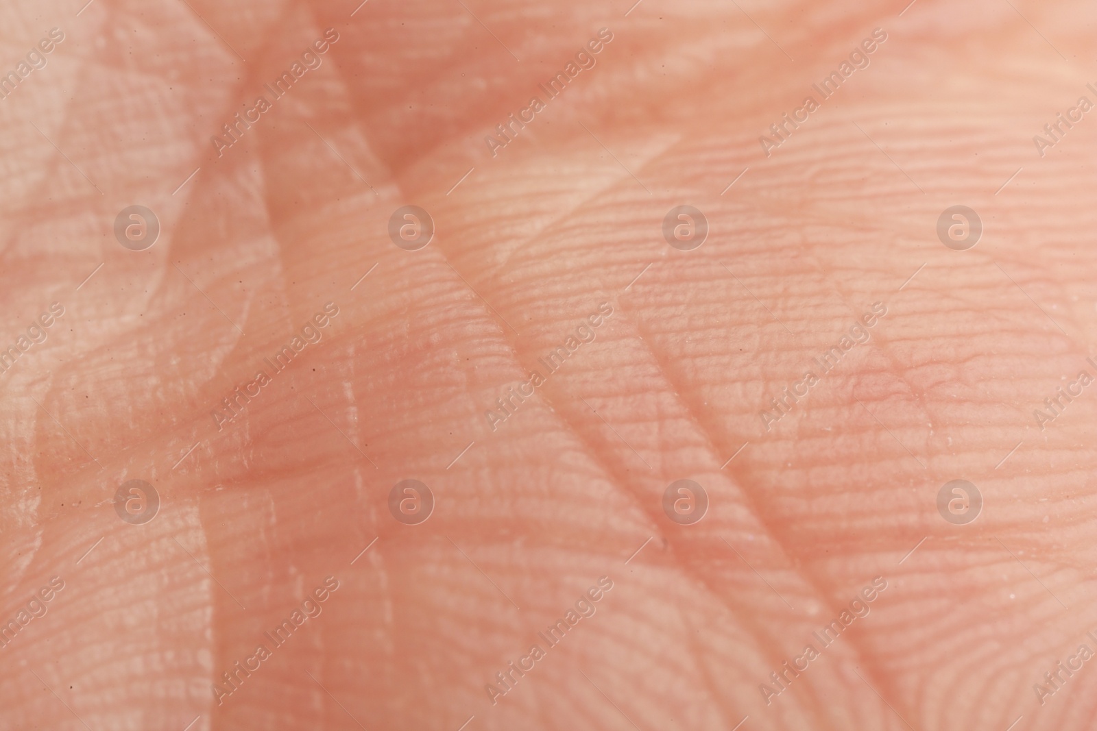 Photo of Texture of dry skin as background, macro view