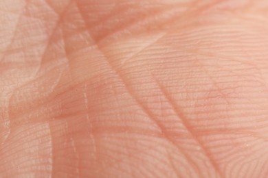 Photo of Texture of dry skin as background, macro view