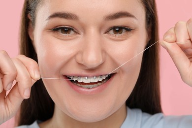 Smiling woman with braces cleaning teeth using dental floss on pink background, closeup