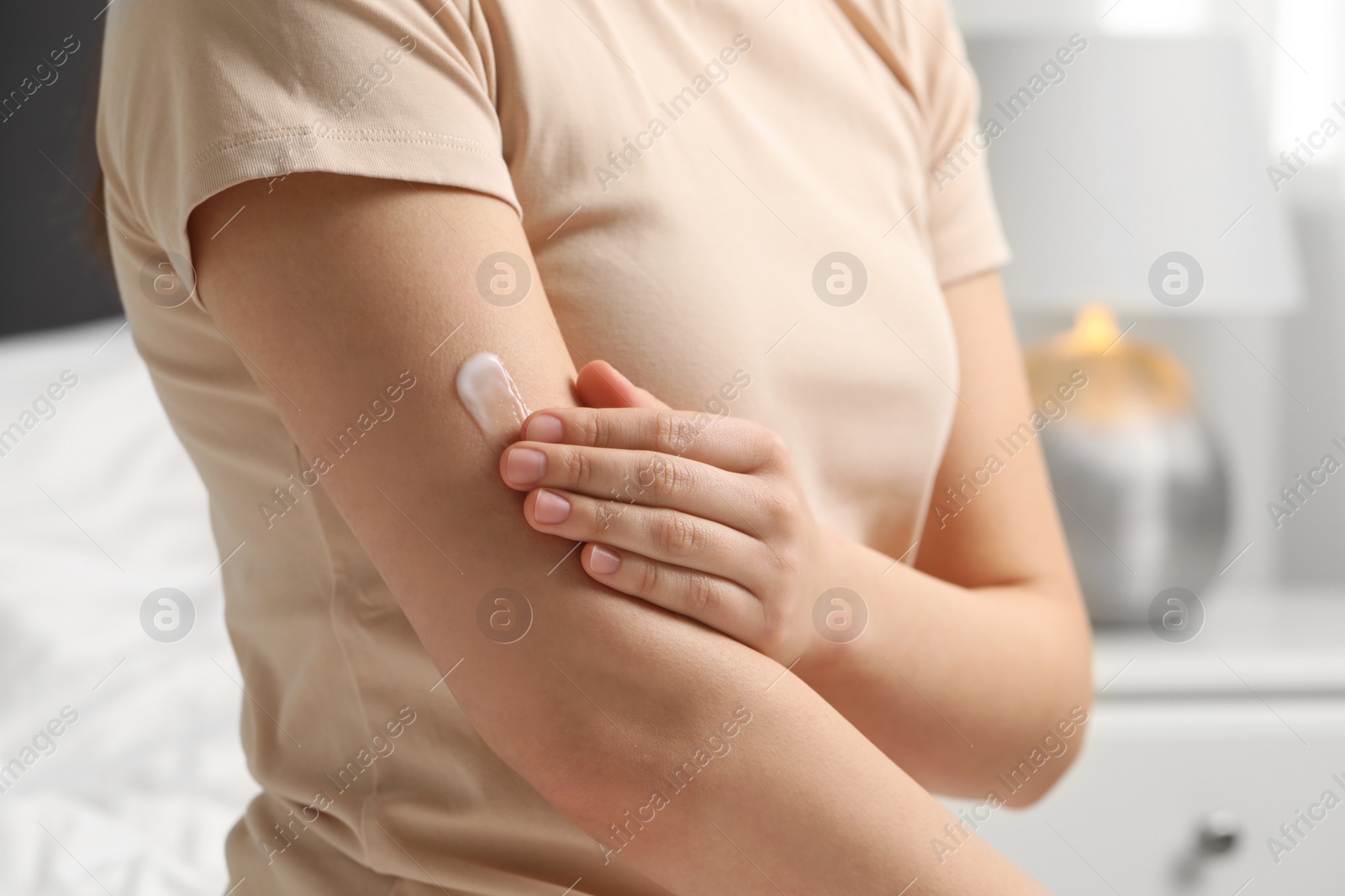 Photo of Young woman with dry skin applying cream onto her arm indoors, closeup