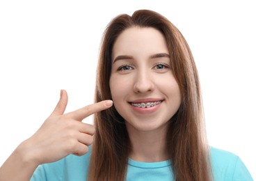 Portrait of smiling woman pointing at her dental braces on white background